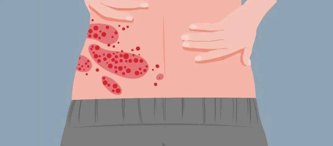 一旦感染终身携带<strong></p>
<p>亿发虚拟币</strong>!深圳疾控提醒:这4类人要注意