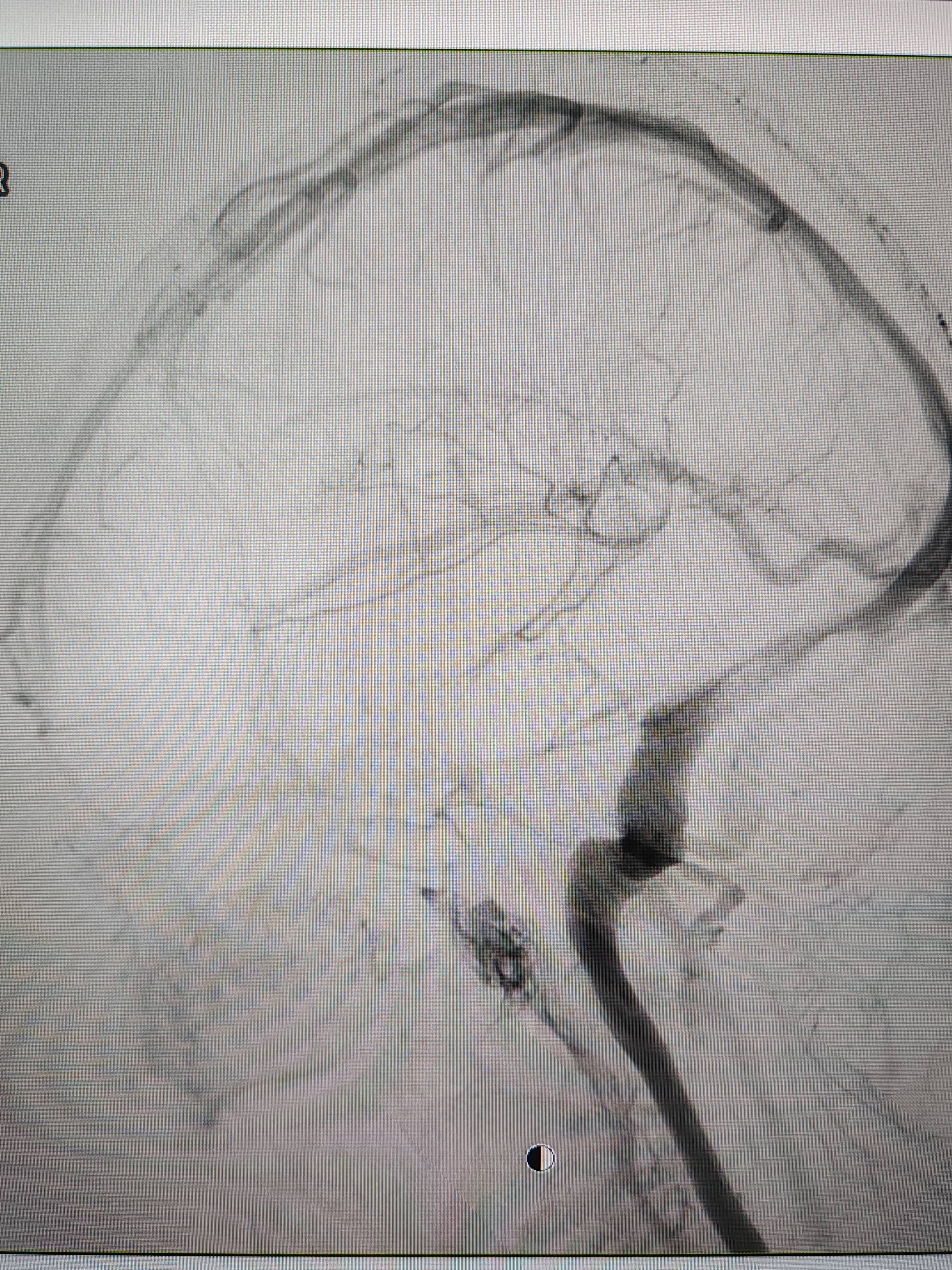 吉林女子患罕见耳鸣7年<strong></p>
<p>虚拟币小伙</strong>,慕名千里来顺德寻医终获新生