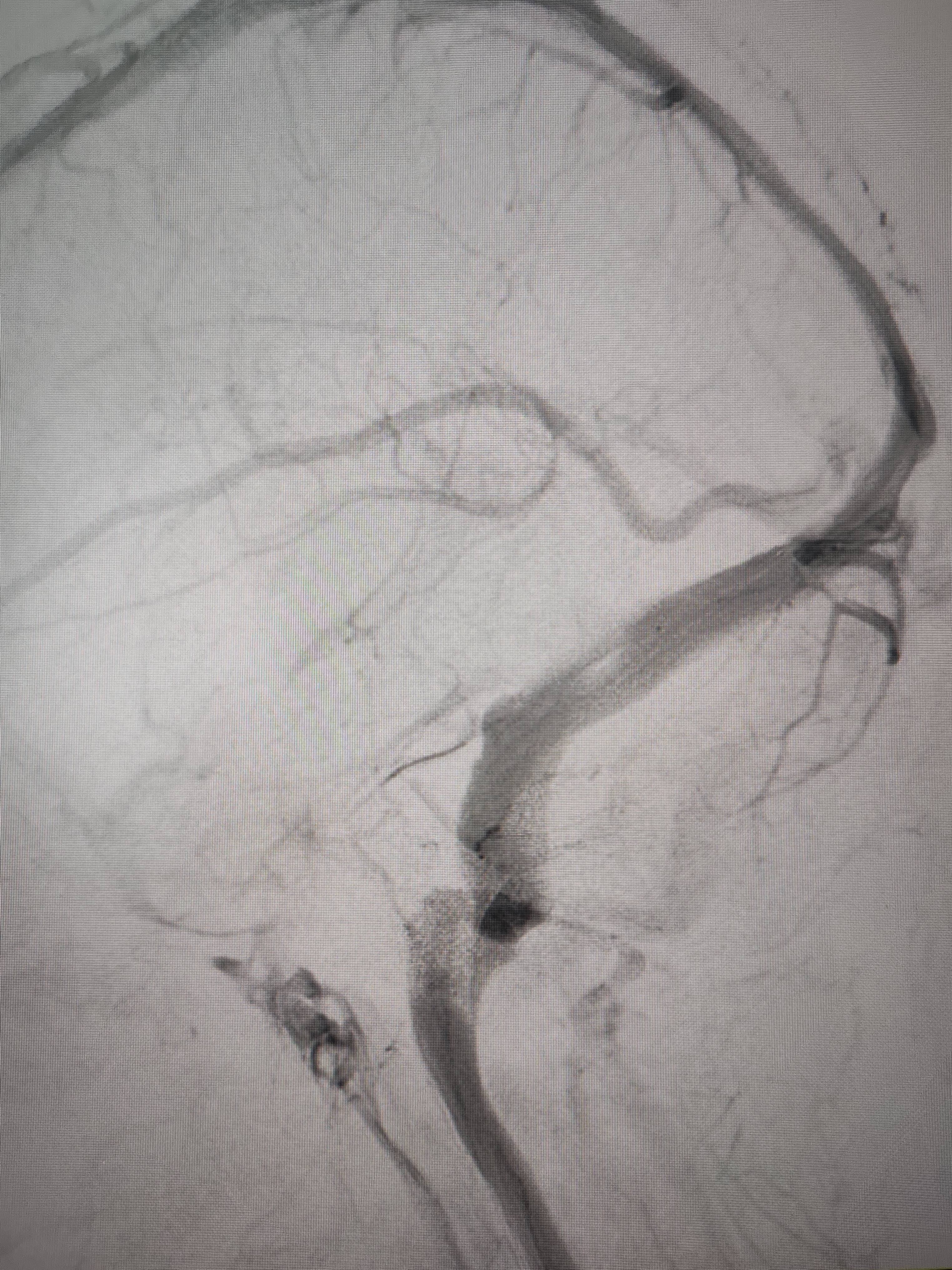 吉林女子患罕见耳鸣7年<strong></p>
<p>虚拟币小伙</strong>,慕名千里来顺德寻医终获新生