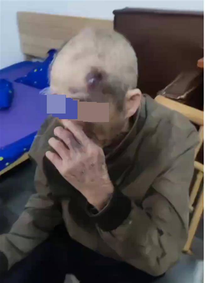 广东阳江一养老院护工长期虐待九旬老人?民政局已介入<strong></p>
<p>虚拟币残币</strong>,警方:正了解情况