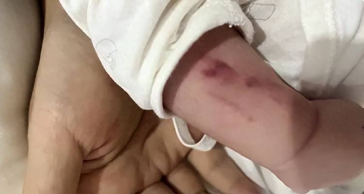 广西一男婴在月子中心被照料20天：身上2处骨折<strong></p>
<p>虚拟币残币</strong>，育婴室监控无法查看