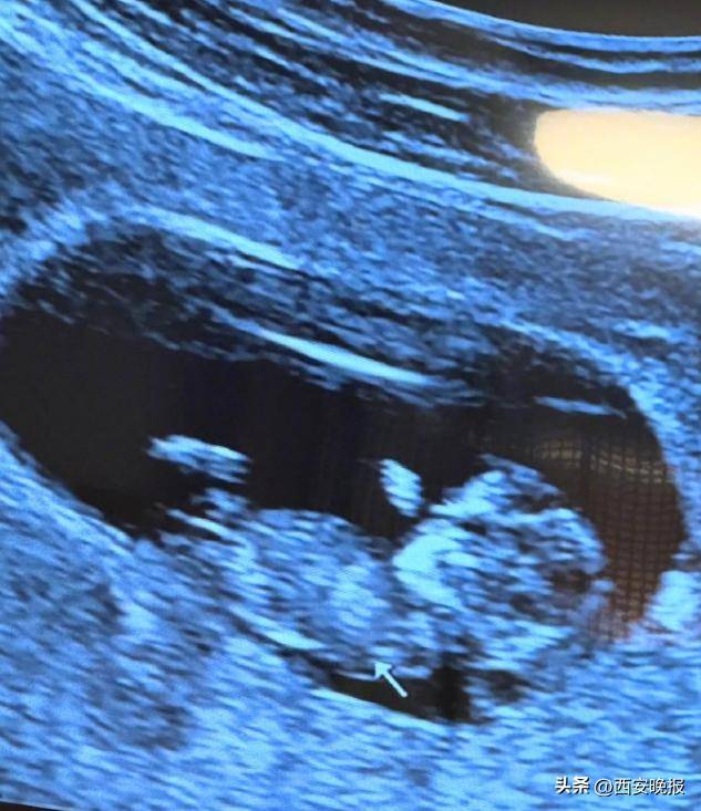 46岁知名女星宣布怀孕<strong></p>
<p>虚拟币止盈</strong>!