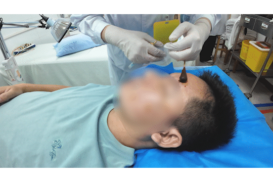 醒来“天塌了”<strong></p>
<p>虚拟币账款</strong>!深圳一女子眼睛闭不上、嘴巴漏水!这些错误很多人会犯