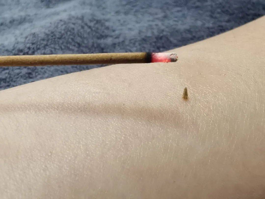 醒来“天塌了”<strong></p>
<p>虚拟币账款</strong>!深圳一女子眼睛闭不上、嘴巴漏水!这些错误很多人会犯