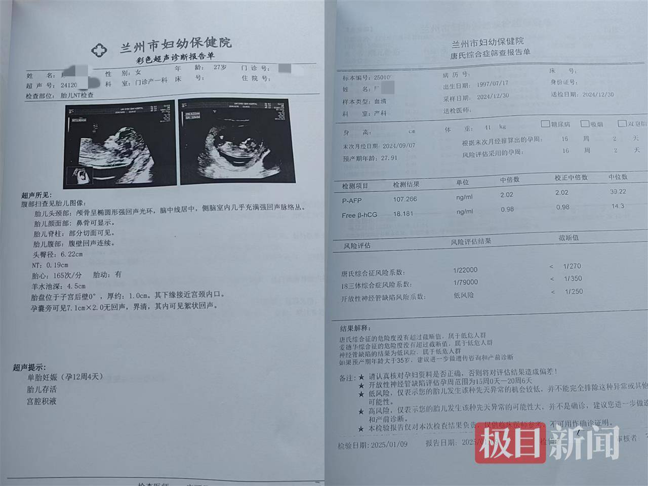 二胎出生查出先天性病症或落下残疾<strong></p>
<p>卡通虚拟币</strong>，残疾父母称医院产检漏检、未尽告知义务，医院及医调委回应