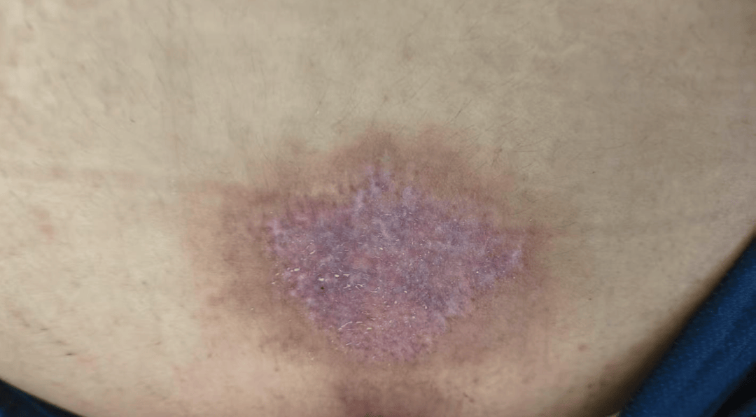 14岁女孩在拓展营遭体罚去世<strong></p>
<p>虚拟币FN</strong>,班主任因截留其给父母信件受审