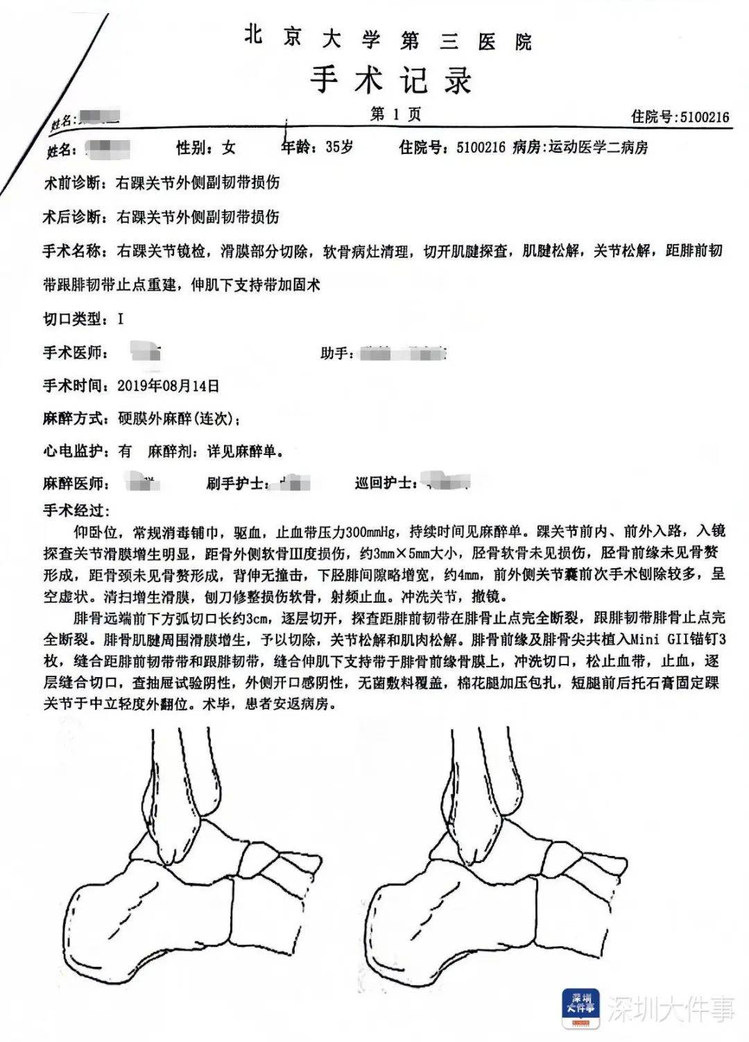 “一走路就痛”!女子脚踝受伤遭漏诊<strong></p>
<p>mk虚拟币</strong>,治了7年没好!深圳一医院被告上法庭