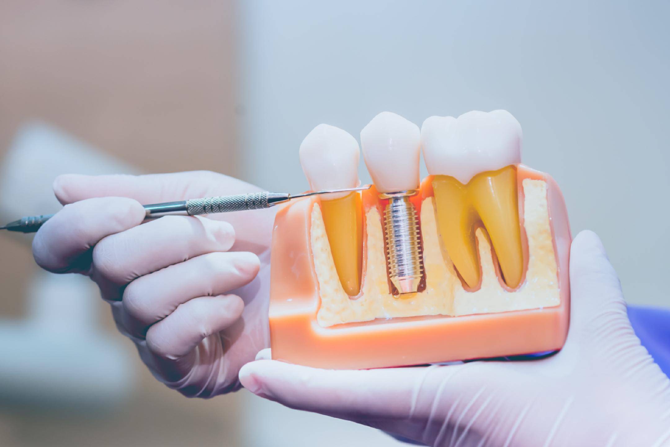 全球牙科龙头登士柏被指以次充好 或涉8万余患者