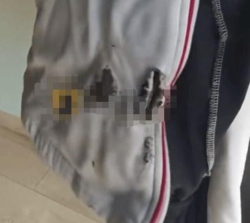 高中生散步时校服突发自燃<strong></p>
<p>虚拟币动画</strong>?原是165元网购的“宝”在惹祸→