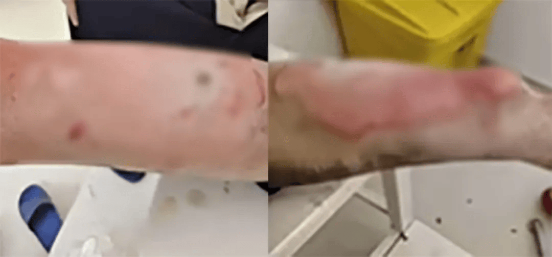 高中生散步时校服突发自燃<strong></p>
<p>虚拟币动画</strong>?原是165元网购的“宝”在惹祸→