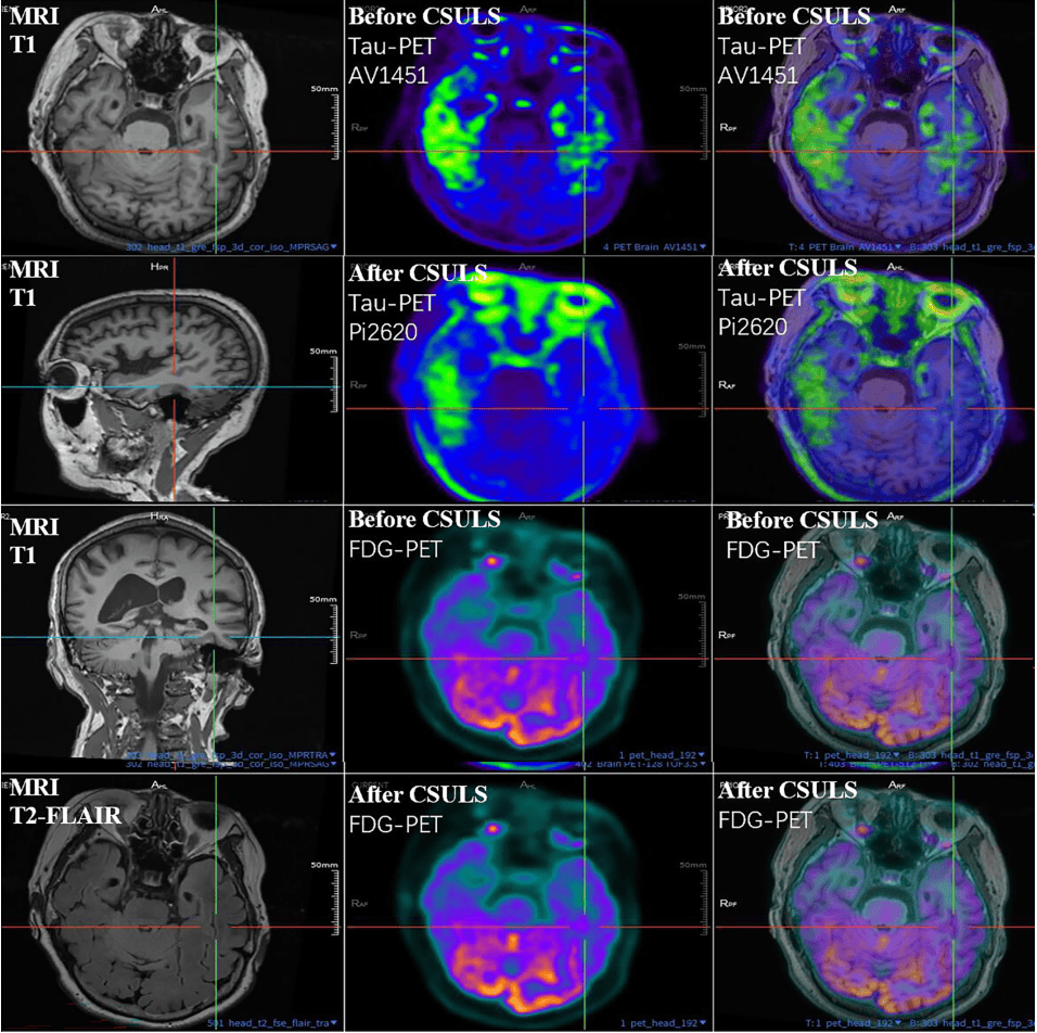 300多家医院抢着做的手术<strong></p>
<p>虚拟币提款</strong>,为何突被禁?
