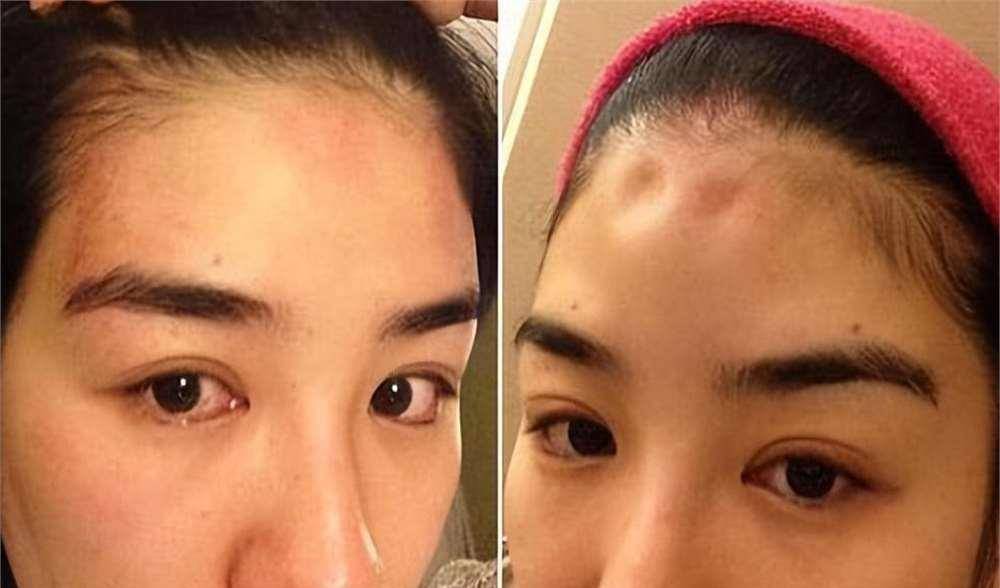 罗霖被家暴17年<strong></p>
<p>带虚拟币</strong>,蓝洁瑛遭性侵暴力还被围观!女明星的暴力事件还有很多