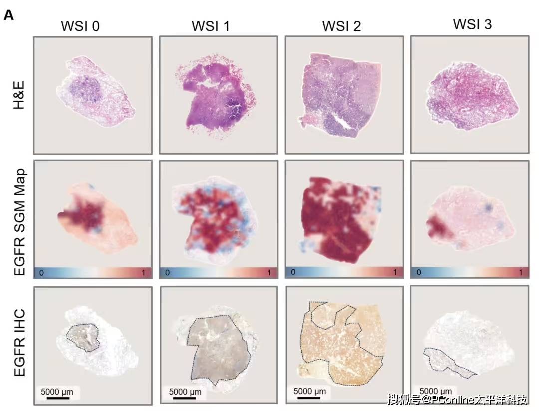 准确率高达 99%<strong></p>
<p>国际数字货币</strong>!腾讯 AI 可预测肺癌基因突变